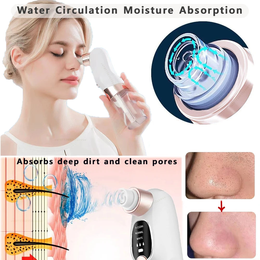 Water Cycle Pore Vacuum
