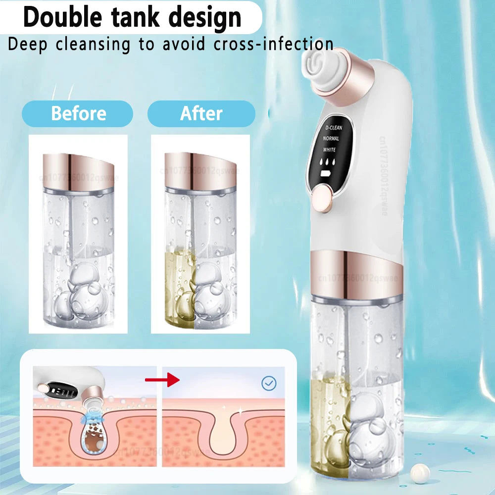 Water Cycle Pore Vacuum